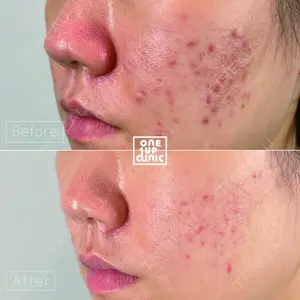 oneUPclinicの症例