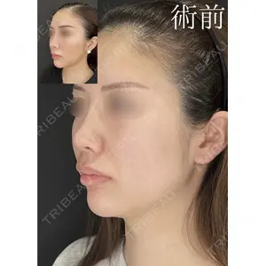 HAAB×DREAM BEAUTY CLINIC 大阪梅田院 鈴木 馨斗医師の症例