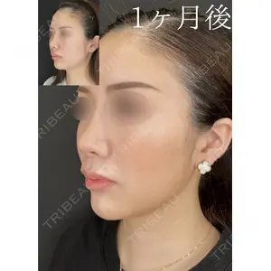 HAAB×DREAM BEAUTY CLINIC 大阪梅田院 鈴木 馨斗医師の症例