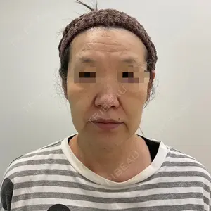 ユウコ形成外科クリニック 植田　有子医師の症例