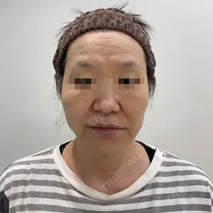 ユウコ形成外科クリニック 植田　有子医師の症例
