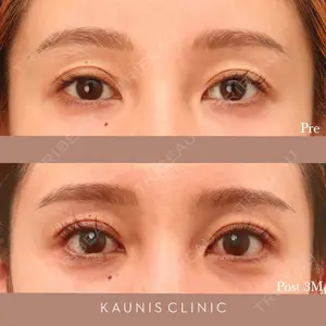 KAUNIS CLINIC（カウニスクリニック） 高野 敏郎医師の症例