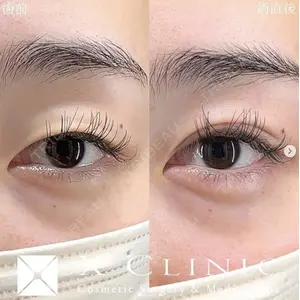 X CLINIC 恵比寿院 辻村 梢医師の症例