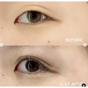 X CLINIC 恵比寿院 辻村 梢医師の症例