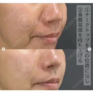 X CLINIC 恵比寿院 辻村 梢医師の症例