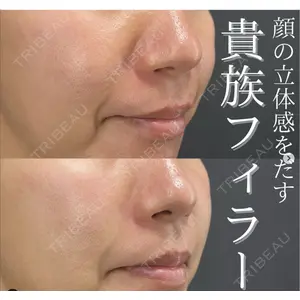 X CLINIC 恵比寿院 辻村 梢医師の症例