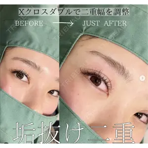 X CLINIC 恵比寿院 辻村 梢医師の症例