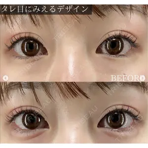 X CLINIC 恵比寿院の症例