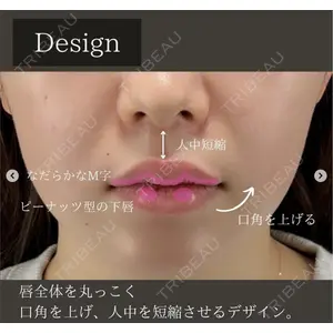 X CLINIC 恵比寿院 辻村 梢医師の症例