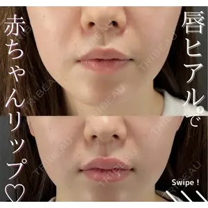 X CLINIC 恵比寿院 辻村 梢医師の症例