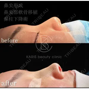 KARIS beauty clinicの症例
