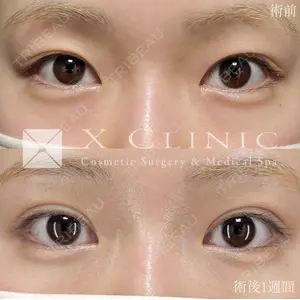 X CLINIC 恵比寿院の症例