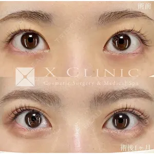 X CLINIC 恵比寿院の症例