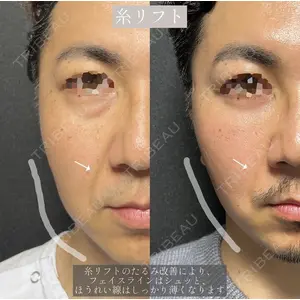 X CLINIC 恵比寿院の症例