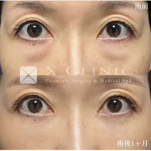 X CLINIC 恵比寿院の症例