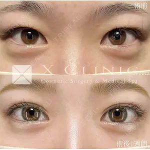 X CLINIC 恵比寿院の症例