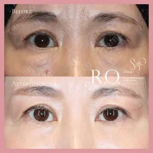 R.O.clinic 辰田　紗世医師の症例