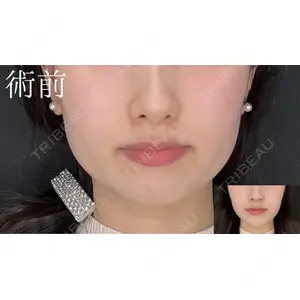 HAAB×DREAM BEAUTY CLINIC 大阪梅田院 鈴木 馨斗医師の症例