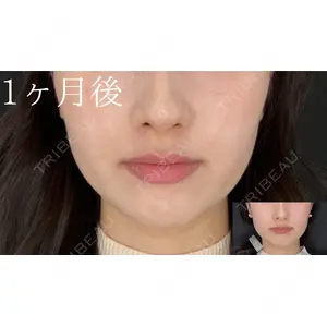 HAAB×DREAM BEAUTY CLINIC 大阪梅田院 鈴木 馨斗医師の症例