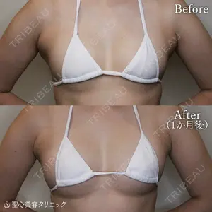 聖心美容クリニック 大宮院 伊藤 哲郎医師の症例