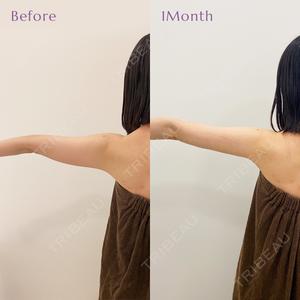 藤・ナチュレ美容クリニック 銀座院の症例