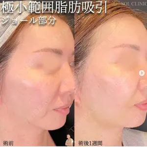 SOL CLINIC 向井 英子医師の症例