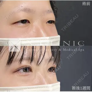 X CLINIC 恵比寿院の症例