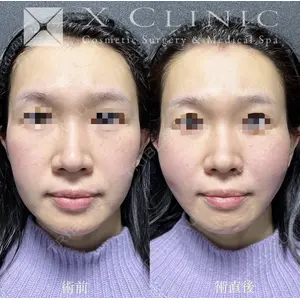 X CLINIC 恵比寿院の症例
