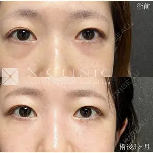 X CLINIC 恵比寿院の症例