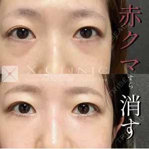 X CLINIC 恵比寿院の症例