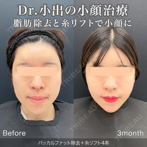 東京シンデレラ美容外科 池袋院の症例