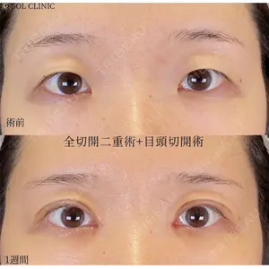 SOL CLINIC 向井 英子医師の症例