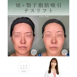 くさのたろうクリニック 立雅恵医師の症例