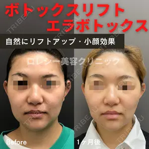 ロレシー美容クリニック 心斎橋駅前院 福留院長医師の症例