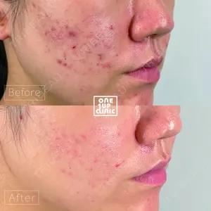 oneUPclinicの症例