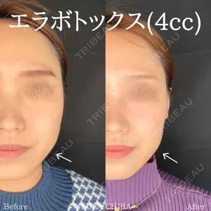 ルラ美容クリニック 千葉院 下川 洋輝医師の症例