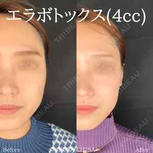 ルラ美容クリニック 千葉院 下川 洋輝医師の症例
