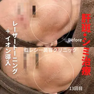 ロレシー美容クリニック 心斎橋駅前院 福留院長医師の症例