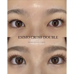 EMMO FACE CLINIC 大宮院 廣松 直樹医師の症例