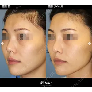 プリモ麻布十番クリニック 大場教弘医師の症例