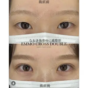 EMMO FACE CLINIC 大宮院 廣松 直樹医師の症例