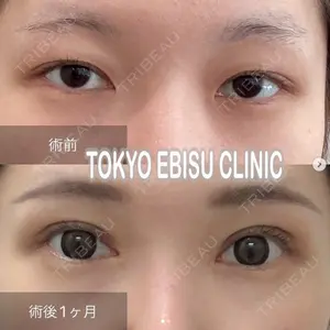東京エビスクリニックの症例