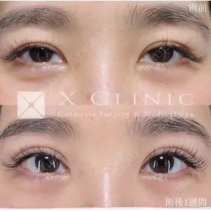 X CLINIC 恵比寿院の症例