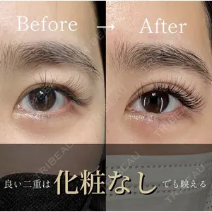 X CLINIC 恵比寿院の症例
