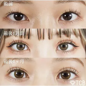 TCB東京中央美容外科 新宿東口院の症例