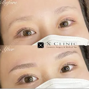 X CLINIC 大阪院の症例