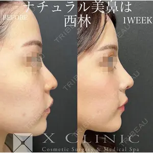 X CLINIC 大阪院 西林章光医師の症例