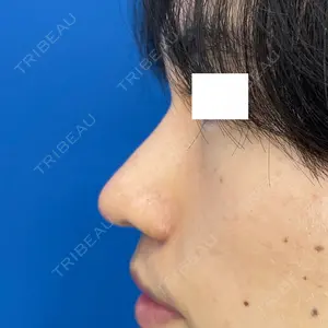 MIL CLINIC OSAKA 岩脇 槙佑医師の症例