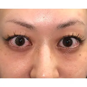 MIL CLINIC OSAKA 岩脇 槙佑医師の症例