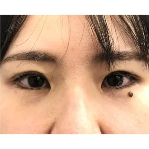 MIL CLINIC OSAKA 岩脇 槙佑医師の症例